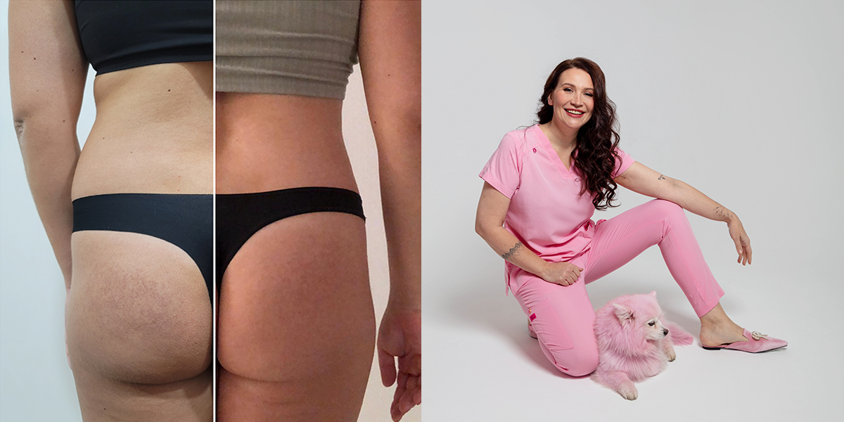 Mira Moore on the Impact of Rapid Weight Loss: How Specialists Are Addressing Changes in Body Structure