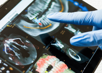 What Type of Dentist Does Implants? Understanding the Role of Implant Dentists