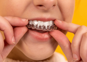 The Impact of Lifestyle Factors on Oral Health