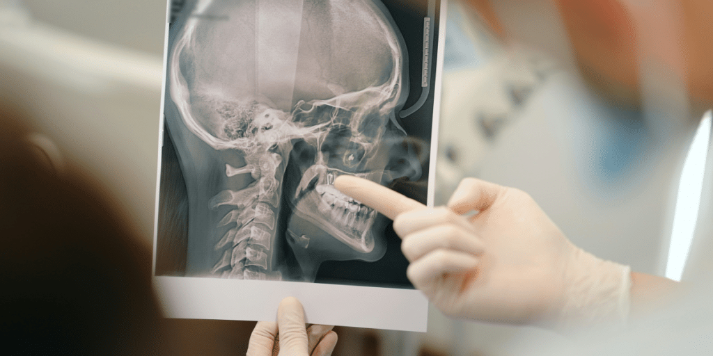 This San Francisco Based Company Is Revolutionizing Brain Imaging with FDA-Approved Technology
