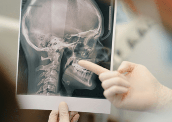 This San Francisco Based Company Is Revolutionizing Brain Imaging with FDA-Approved Technology