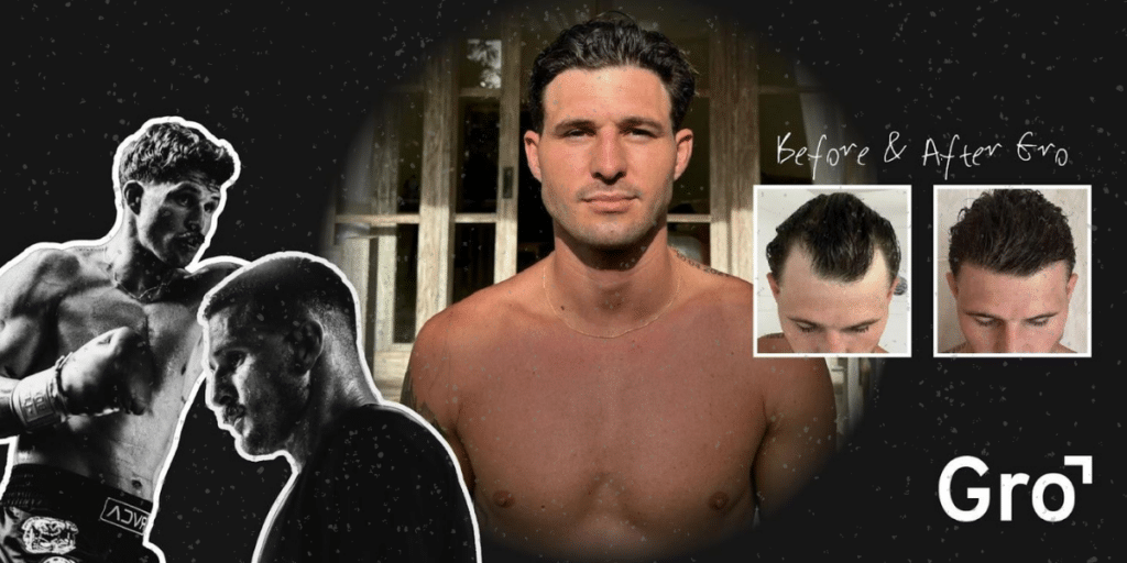 Gro Clinics Offers Hair Restoration Consultations