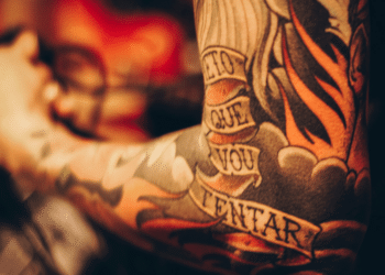 Benefits of Tattoo Removal Why You Should Consider It