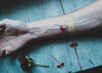 Personal Injury Claims What You Need to Know