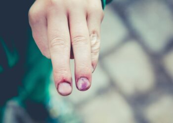 What to Do Legally If You Are a Victim of a Product Malfunction