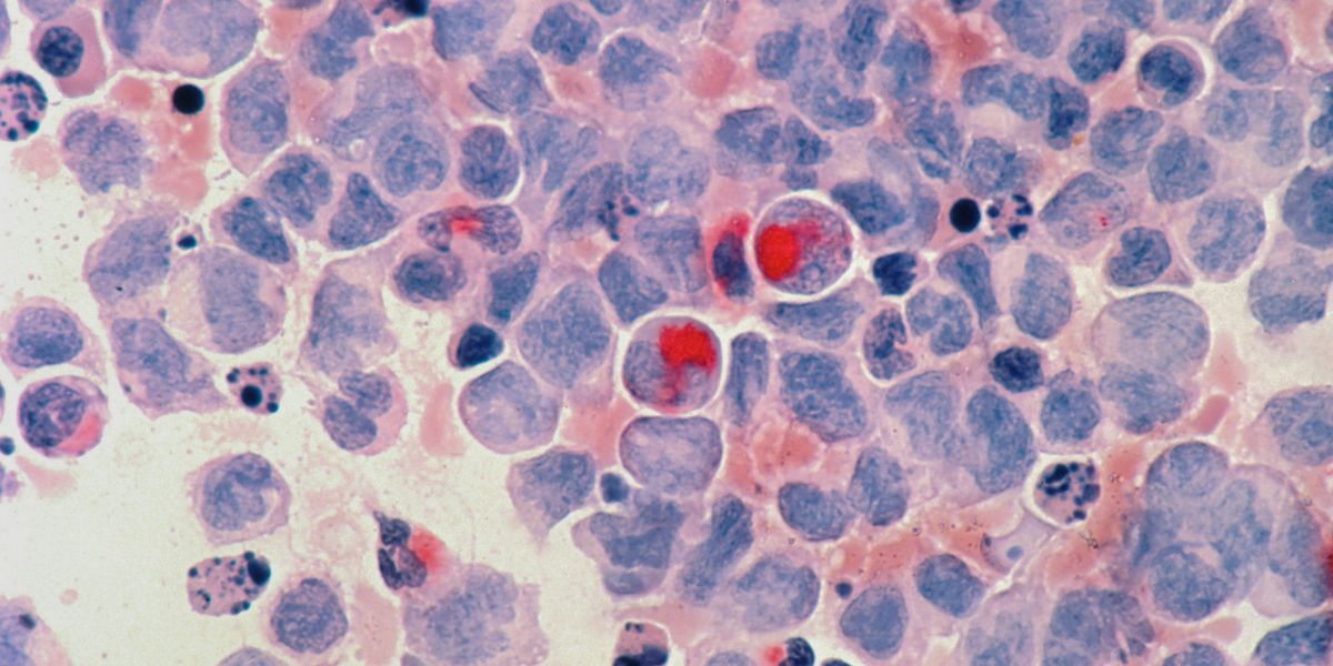 Understanding the Different Types of Cells: From Prokaryotic to Specialized and Stem Cells
