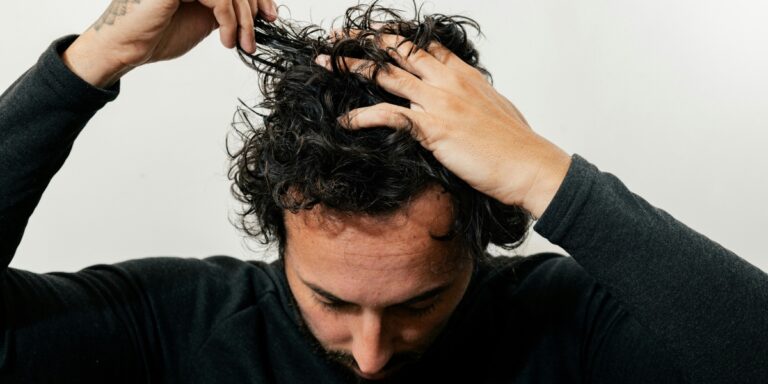 Hair Replacement Myths vs Facts: What Men Should Know