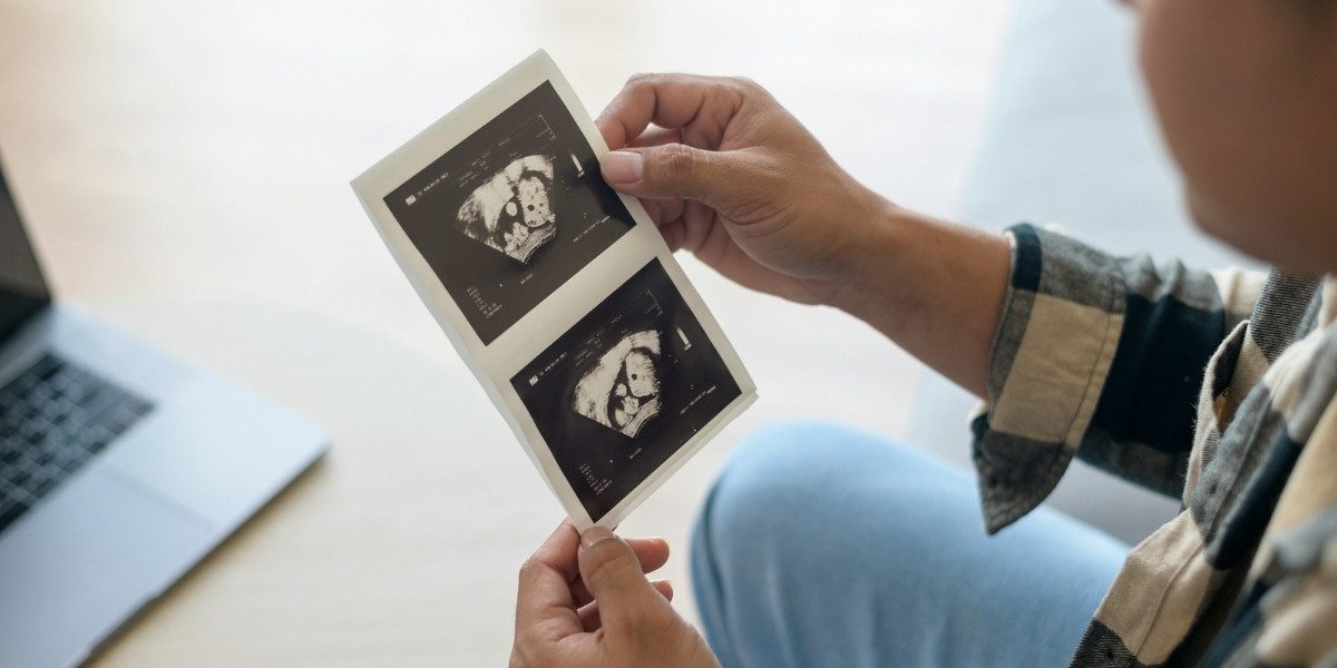 Advances in Prenatal Paternity Testing: What Expecting Parents Need to Know