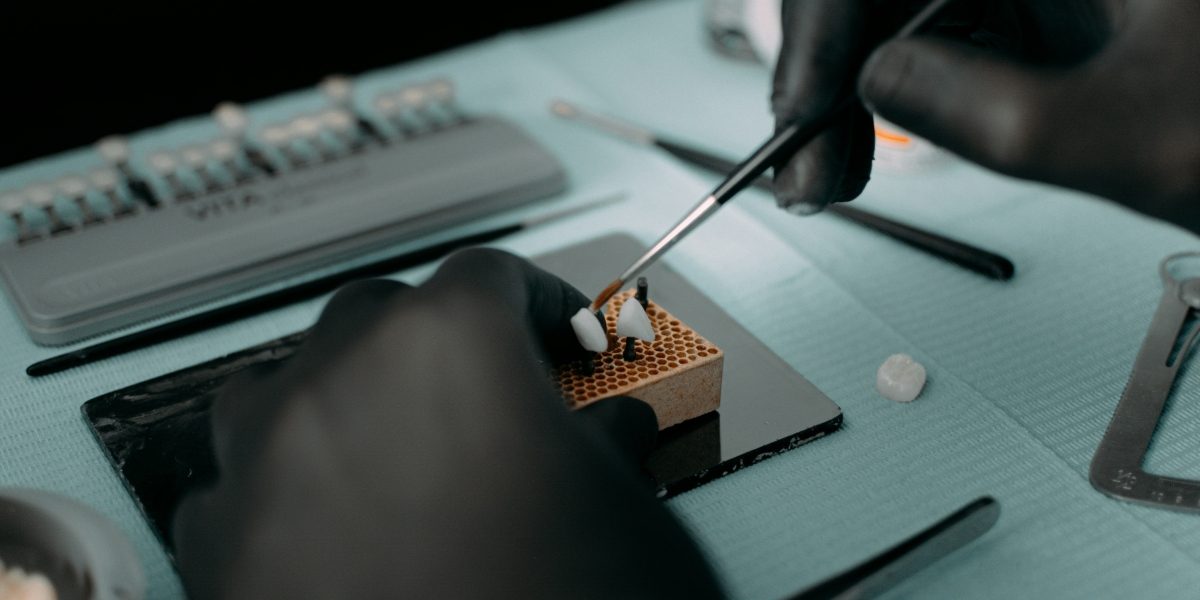 Why Fixing That Chip Now Can Save You Thousands